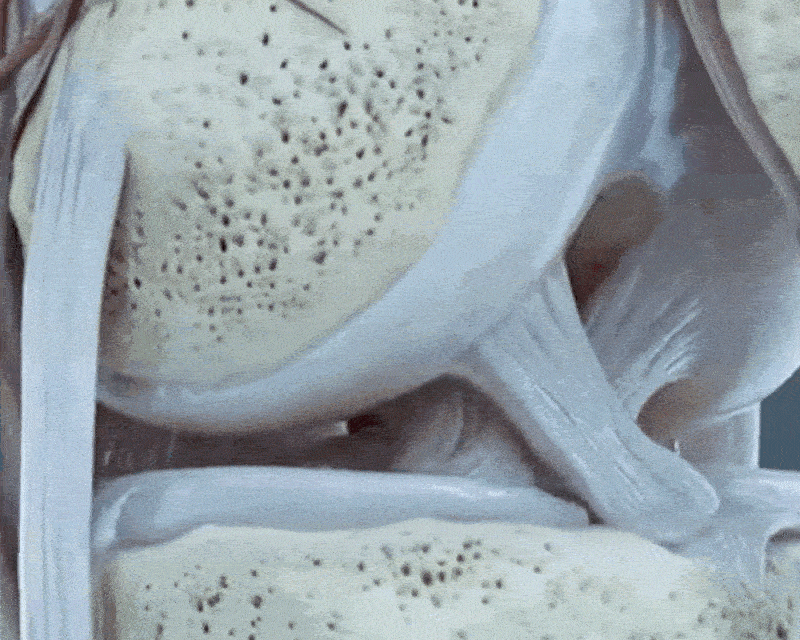 Cartilage health